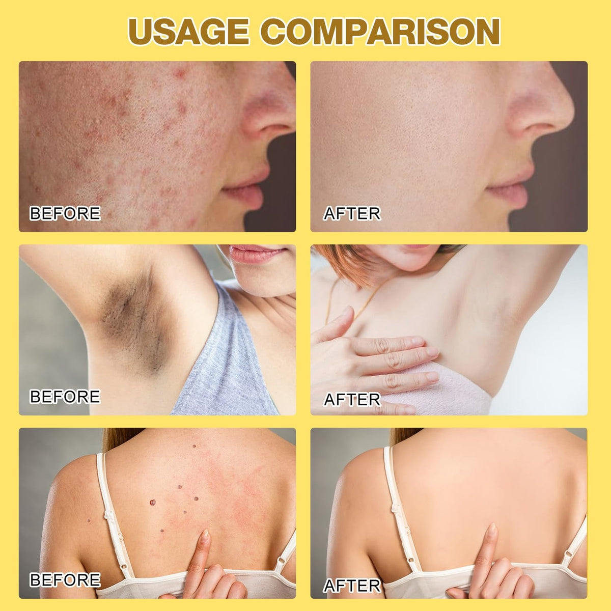 Bee Venom cream application massage