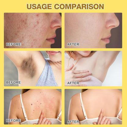 Bee Venom cream application massage